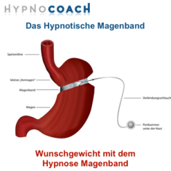 Das Hypnose Magenband - Das Hypnotische Magenband